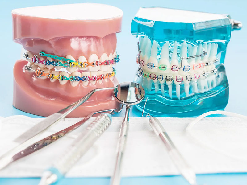 Orthodontist in Bawana Delhi