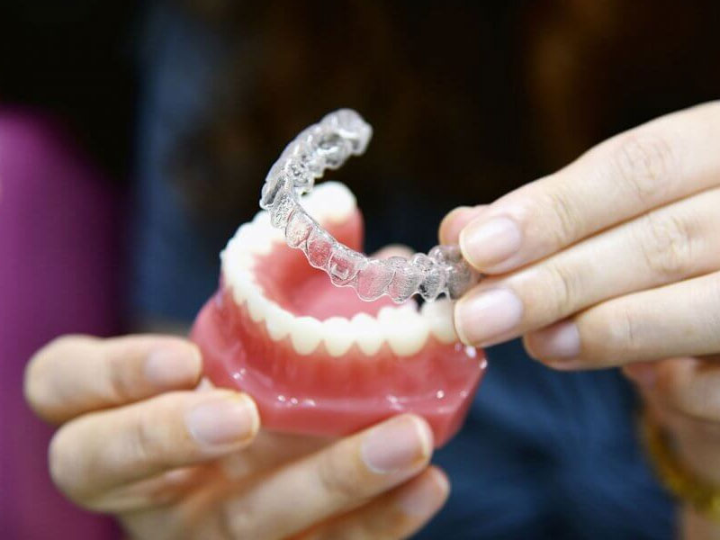 invisible braces cost in Bawana Delhi