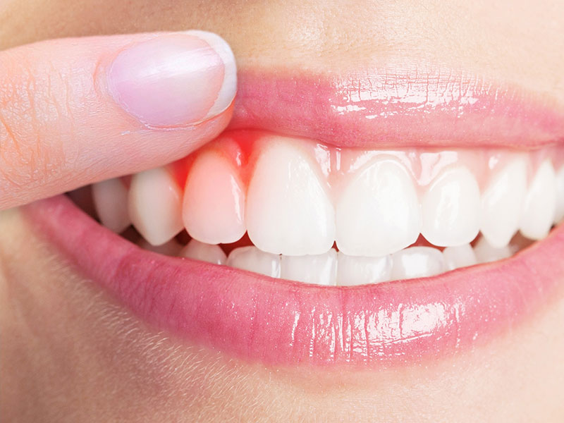 Best Periodontist in Bawana Delhi