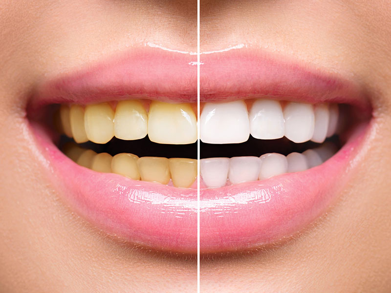 Best Orthodontic Clinic in Bawana, Delhi