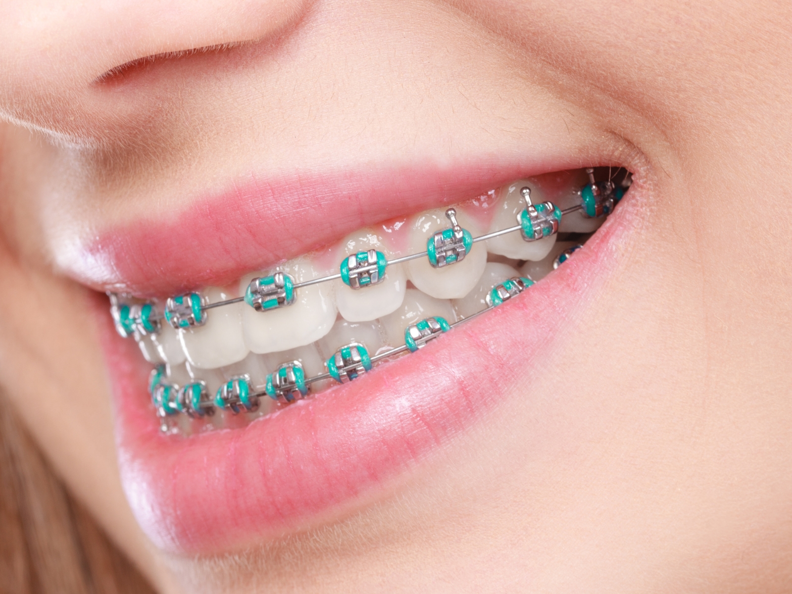 Best Dental Clinic in Bawana, Delhi