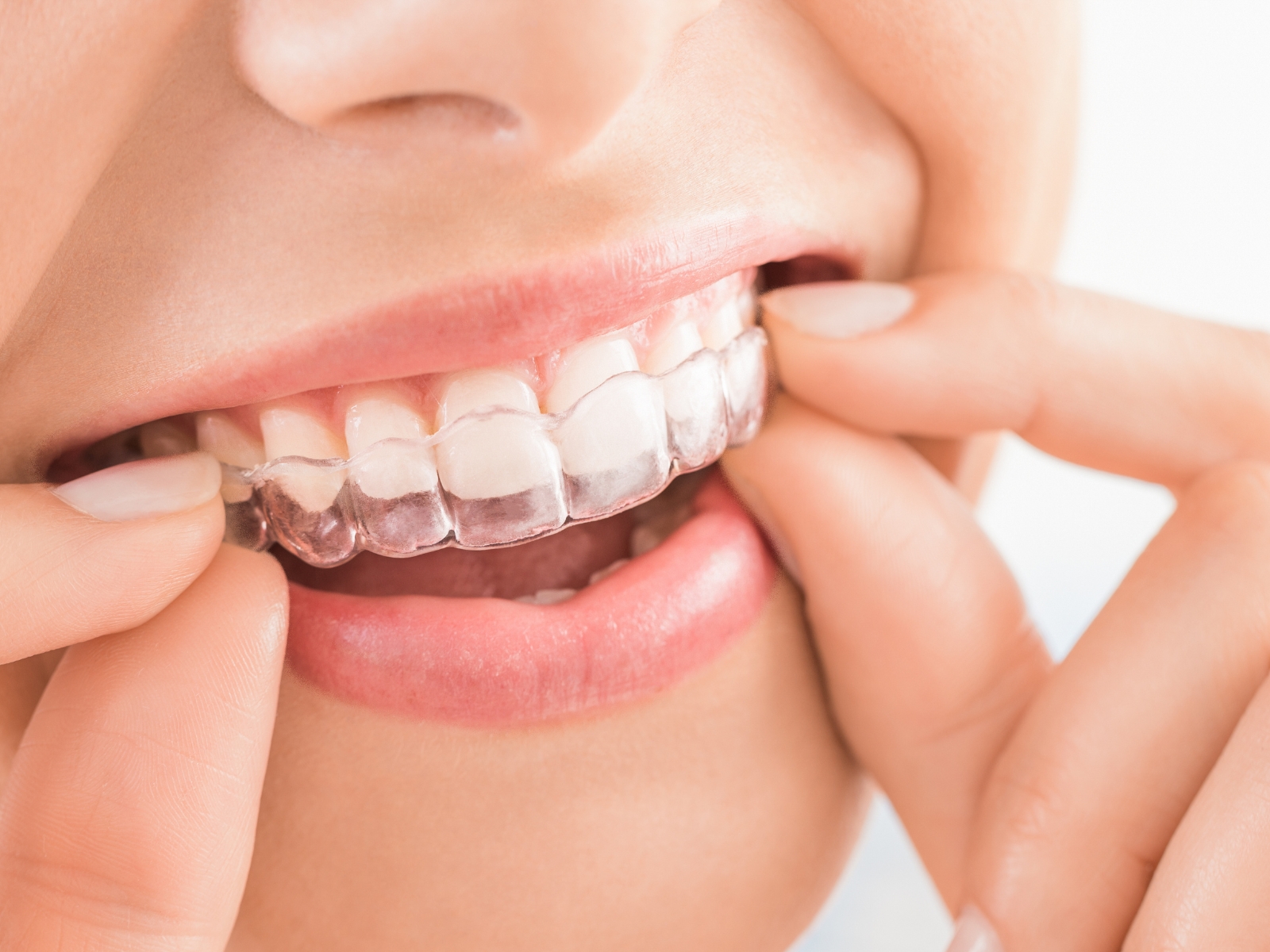 Top Dental Clinic in Bawana, Delhi